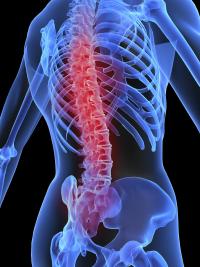 Prevent low back pain